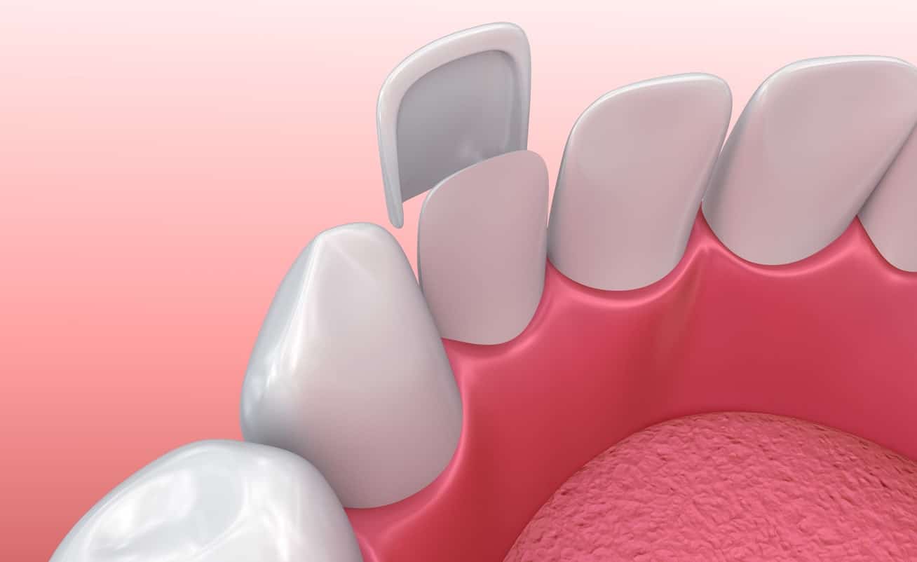 smile dentist smile dentist