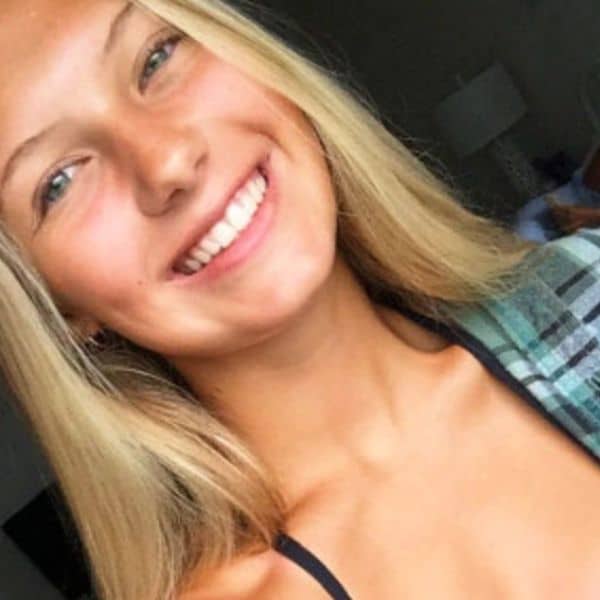 Braces Before And After Braces Before And After