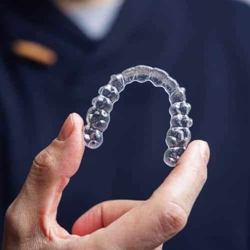 braces clear invisalign (4) how much does Invisalign cost in dublin and cork