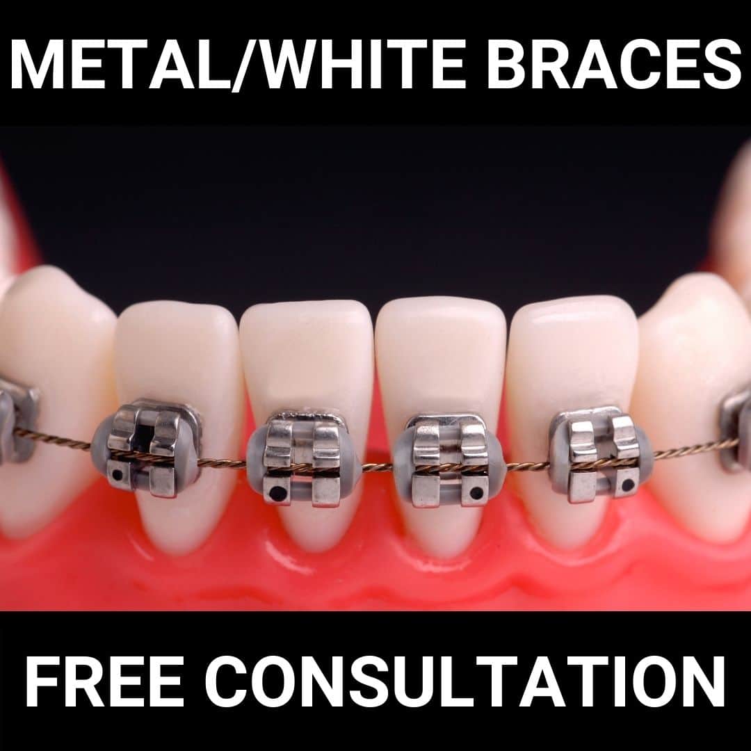 braces dublin