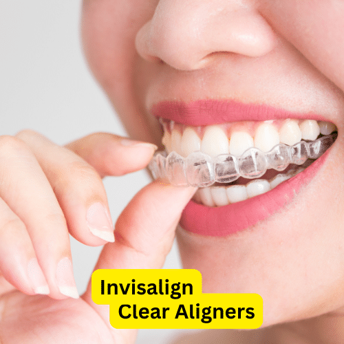 Invisalign how much does Invisalign cost in dublin and cork