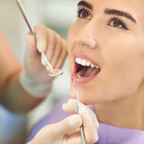 white fillings (2) fillings for teeth