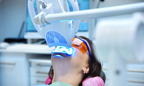 teeth whitening