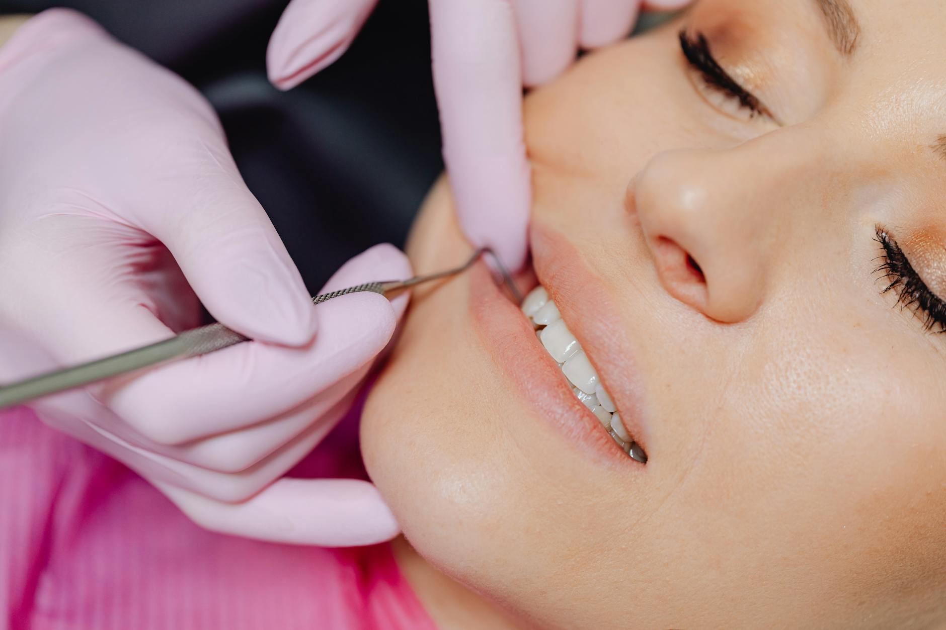 dental bonding dublin - dentist applying composite resin to patient tooth